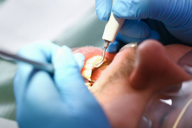 Best Cracked Tooth Emergency Dentist  in Gonzales, LA