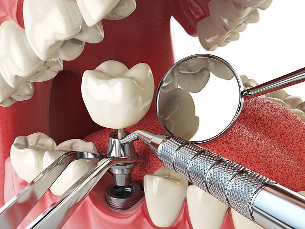 Best Cracked Tooth Emergency Dentist  in Gonzales, LA